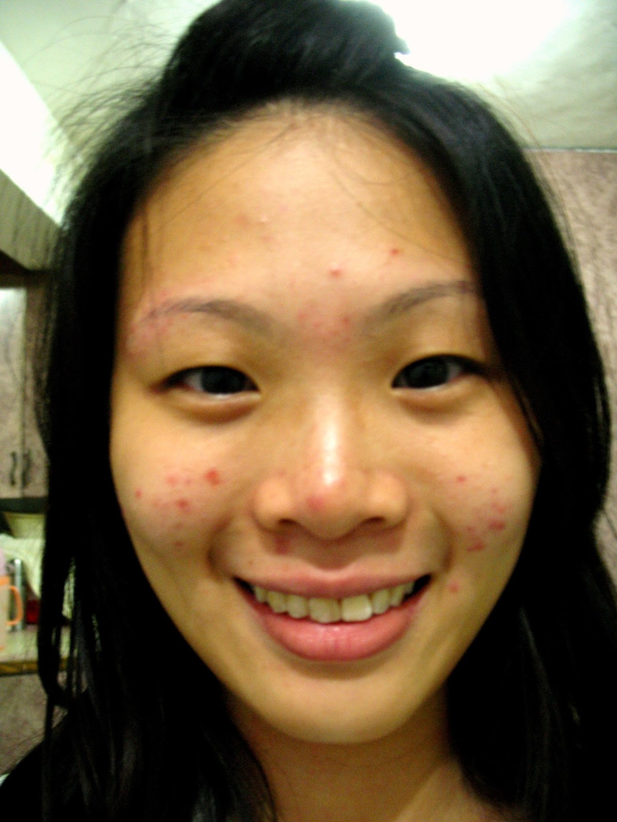 amazing busty bodies pimple face girl naked